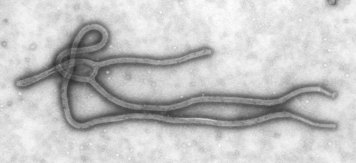 Lawrenzi, MD: The US Is Covering Up Number Of Ebola Cases