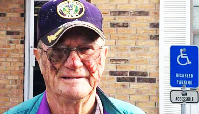 Police Severly Beat 80-Year-Old Man Who Was Complaining About Utility Crew On His Property