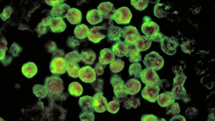 First Confirmed US Death From Contracting Brain-eating Amoeba Through Tap Water