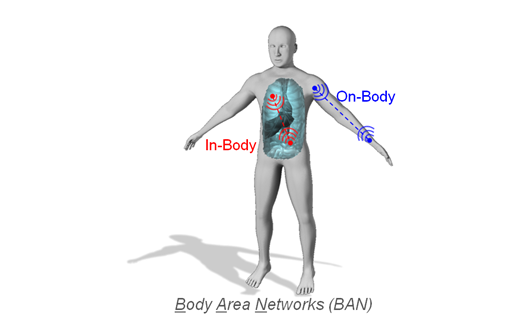 Feds Financing Project To Implant People With A “Body Antenna”