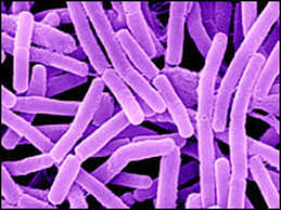 Oops. Anthrax Distribution in U.S.A. Shockingly Common