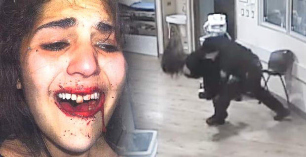 Colorado Cop Slams Handcuffed Teen Into Concrete Floor, Knocking Her Teeth Out