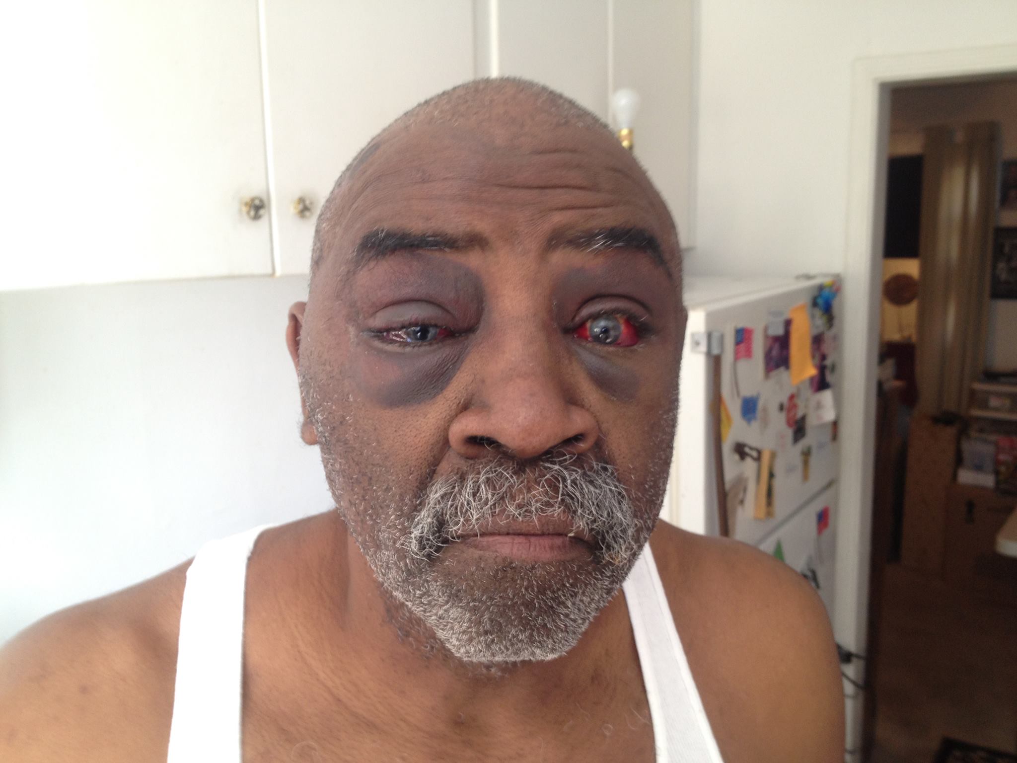 Cops Beat Eldery Deaf Man For Refusing Orders